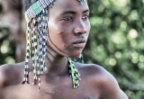 A young woman with scars